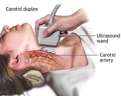 carotid1.jpg